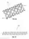 Fig. 17 - Two-way adjustable implant