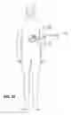 Fig. 22 - Two-way adjustable implant