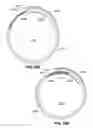 Fig. 27 - Two-way adjustable implant