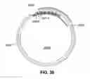 Fig. 28 - Two-way adjustable implant