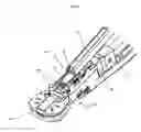 Fig. 05 - Medical device installation tool