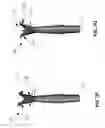 Fig. 27 - SYSTEM AND METHOD FOR POSITIONING A LAPAROSCOPIC DEVICE