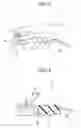 Fig. 03 - Endoscopy system