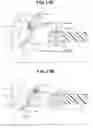 Fig. 12 - Endoscopy system