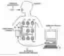 Fig. 01 - In-vivo image capturing apparatus