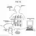 Fig. 16 - In-vivo image capturing apparatus