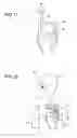 Fig. 18 - In-vivo image capturing apparatus