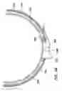 Fig. 15 - Split hoop wound retractor with gel pad
