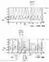 Fig. 12 - SYSTEMS AND METHODS FOR PROCESSING PULMONARY FUNCTION DATA