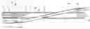 Fig. 01 - Wire guide having distal coupling tip