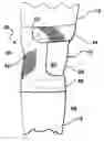Fig. 01 - Knee brace and methods of use and modification thereof