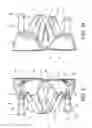 Fig. 06 - Spacer element for prosthetic and orthotic devices