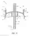 Fig. 04 - Infusion set