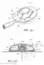 Fig. 11 - Infusion set
