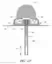 Fig. 20 - Infusion set
