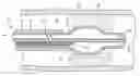 Fig. 01 - Cryo-perfusion balloon device