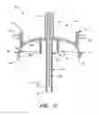 Fig. 04 - Infusion set