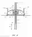 Fig. 08 - Infusion set
