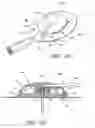 Fig. 22 - Infusion set