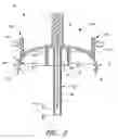 Fig. 04 - Infusion set