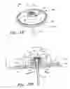 Fig. 17 - Infusion set