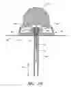Fig. 20 - Infusion set