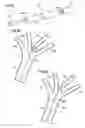 Fig. 05 - Vascular occlusion delivery
