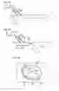 Fig. 07 - Vascular occlusion delivery