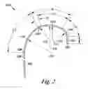 Fig. 03 - Coronary sinus lead delivery catheter
