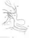Fig. 02 - Device for local ablation of tissue