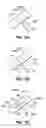 Fig. 05 - Tissue ablation probes and methods for treating osteoid osteomas