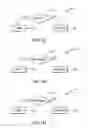 Fig. 16 - Robotic surgical system and method for automated creation of ablation lesions