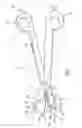 Fig. 02 - Electrosurgical instrument with opposing jaws, central knife, and barbs for maintaining clamping tension on tissue even after opening jaws