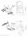 Fig. 08 - Devices and Methods for Inter-Vertebral Orthopedic Device Placement