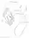 Fig. 32 - Devices and Methods for Inter-Vertebral Orthopedic Device Placement