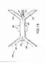 Fig. 10 - Percutaneous interspinous distraction device and method
