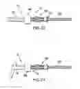 Fig. 13 - Percutaneous interspinous distraction device and method