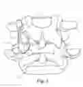 Fig. 04 - Linked bilateral spinal facet implants and methods of use