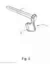 Fig. 06 - Linked bilateral spinal facet implants and methods of use
