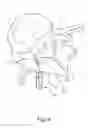 Fig. 09 - Linked bilateral spinal facet implants and methods of use