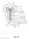 Fig. 28 - Linked bilateral spinal facet implants and methods of use