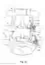 Fig. 35 - Linked bilateral spinal facet implants and methods of use