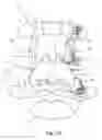 Fig. 37 - Linked bilateral spinal facet implants and methods of use