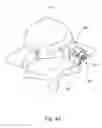 Fig. 45 - Linked bilateral spinal facet implants and methods of use