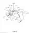 Fig. 49 - Linked bilateral spinal facet implants and methods of use
