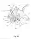 Fig. 50 - Linked bilateral spinal facet implants and methods of use