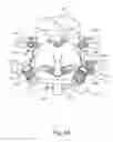 Fig. 64 - Linked bilateral spinal facet implants and methods of use