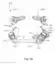 Fig. 69 - Linked bilateral spinal facet implants and methods of use