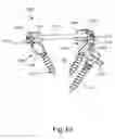 Fig. 71 - Linked bilateral spinal facet implants and methods of use