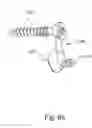 Fig. 72 - Linked bilateral spinal facet implants and methods of use